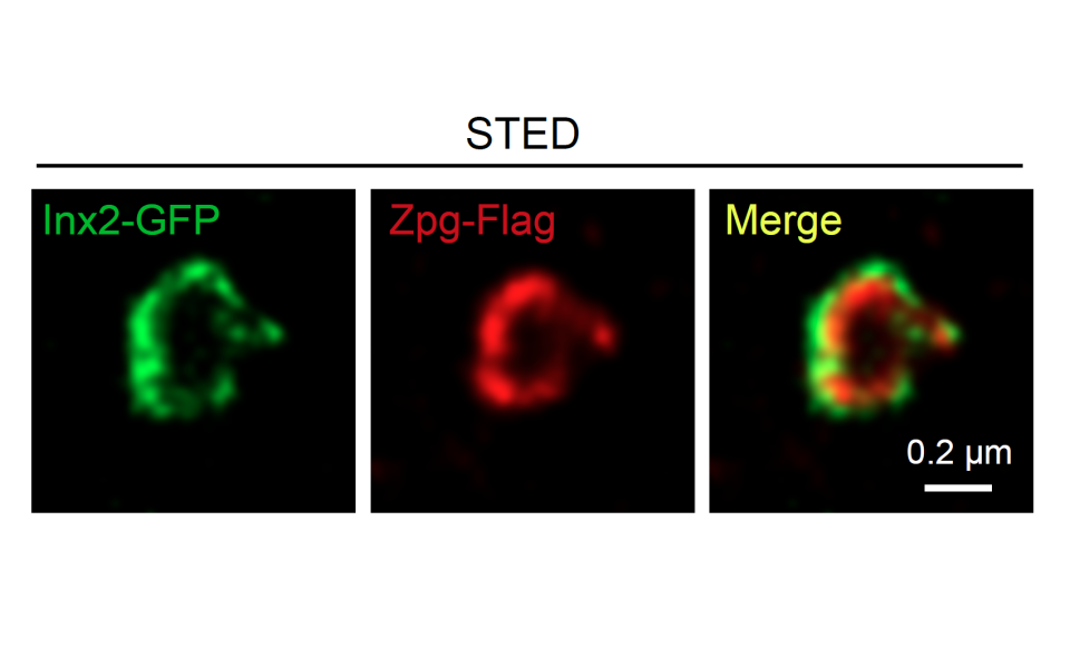 (左) 在幹細胞微環境中表達的「間隙連接蛋白」; (中) 在幹細胞中表達的「間隙連接蛋白」; (右) 幹細胞微環境和幹細胞中的間隙連接蛋白形成的通道