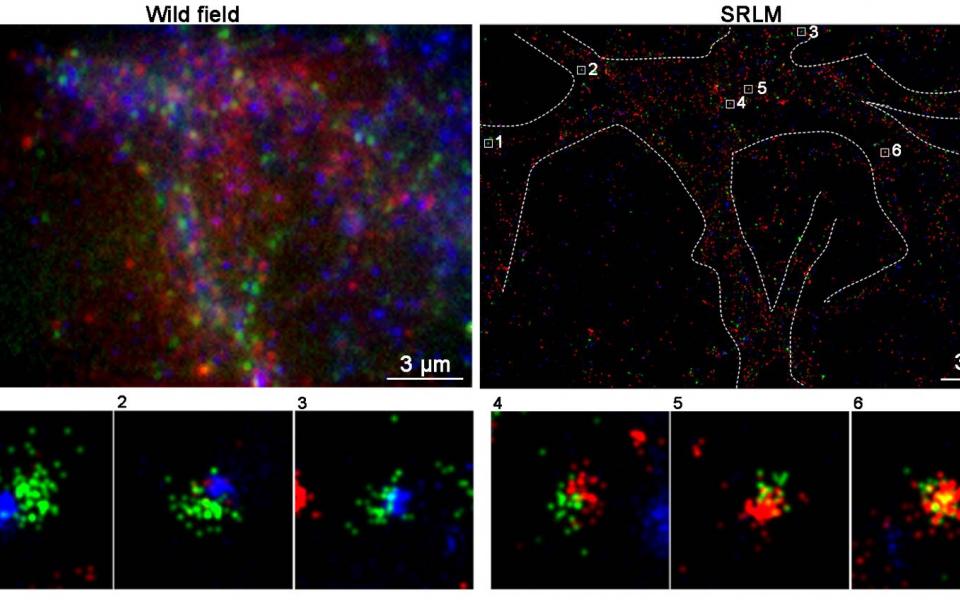  Images taken by HKUST’s SRLM microscope (upper right – break down to 1-6) are much sharper than those by regular ones (upper left), allowing researchers to discover for the first time that ATM (blue) and ATR (red) were never found on the same synaptic vesicle (green).